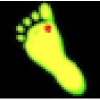 Time oxygen healing concepts LLC/Wounddoctors