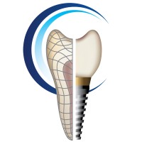 Georgia Prosthodontics - Smile Specialists